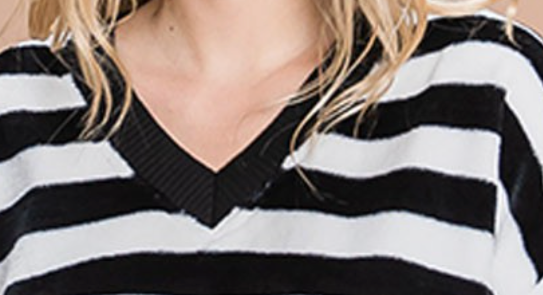 Striped Faux Fur Pullover B&W